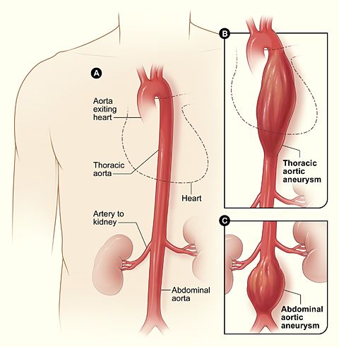 Beyond the surgery: A father’s health scare